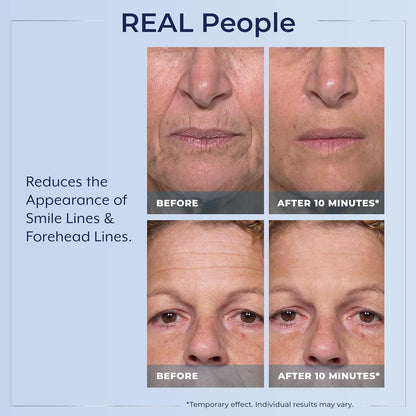 Plexaderm Rapid Reduction Serum
